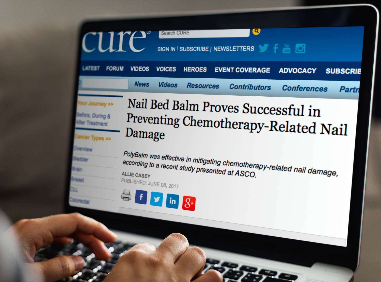 Cure Today - Nail Bed Balm Proves Successful in Preventing Chemotherapy-Related Nail Damage