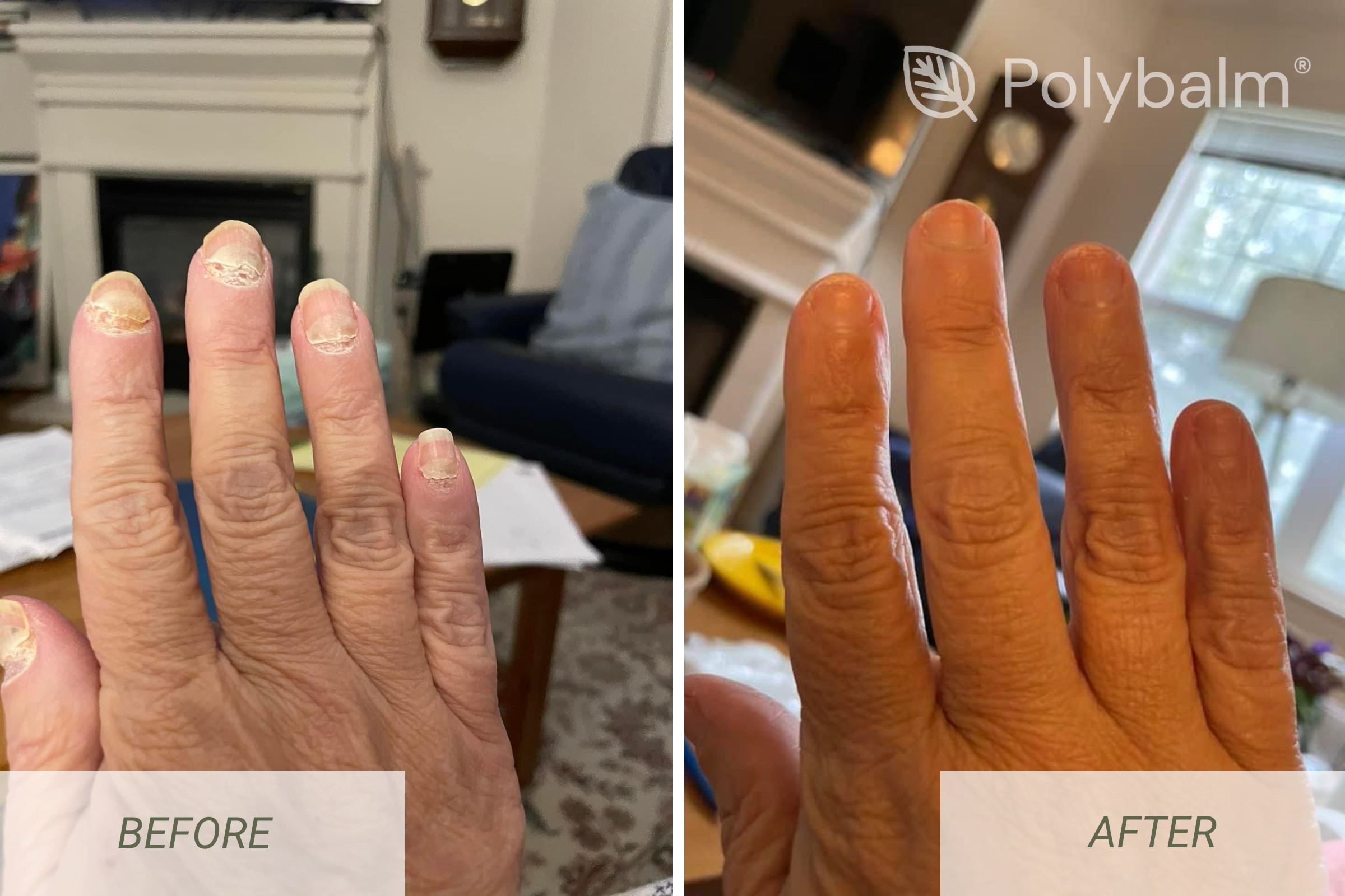 Before and After Polybalm